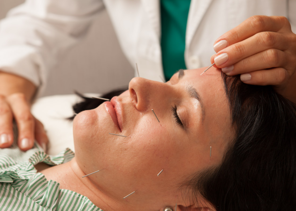 Steven Chasens, DOM, Acupuncturist