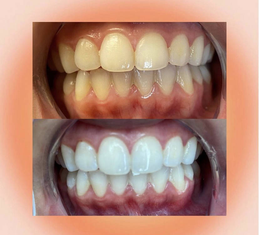 Sunny Smiles LLC