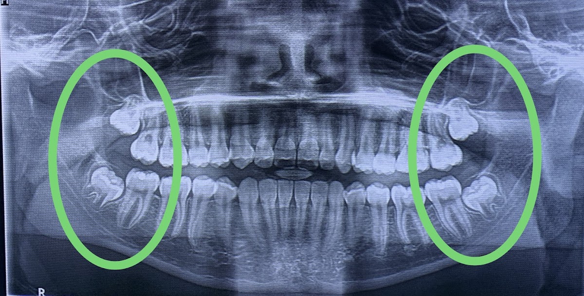 Dr. Johanny Caceres. Oral & Facial Surgery Of Miami