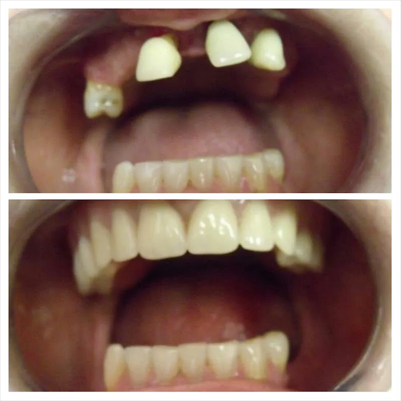 BL Dental Miami, Dr. Lizette Barzaga, DMD