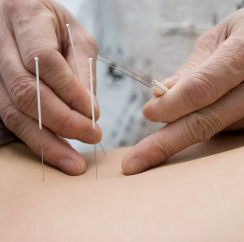 Five Element Acupuncture, Qi Gong & Zero Balancing | Dava Michelson, AP