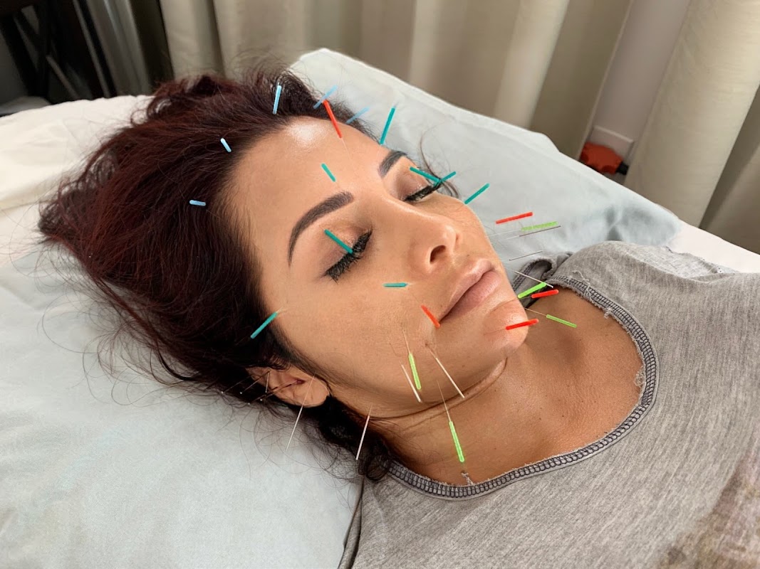 Odin Gutierrez Acupuncture
